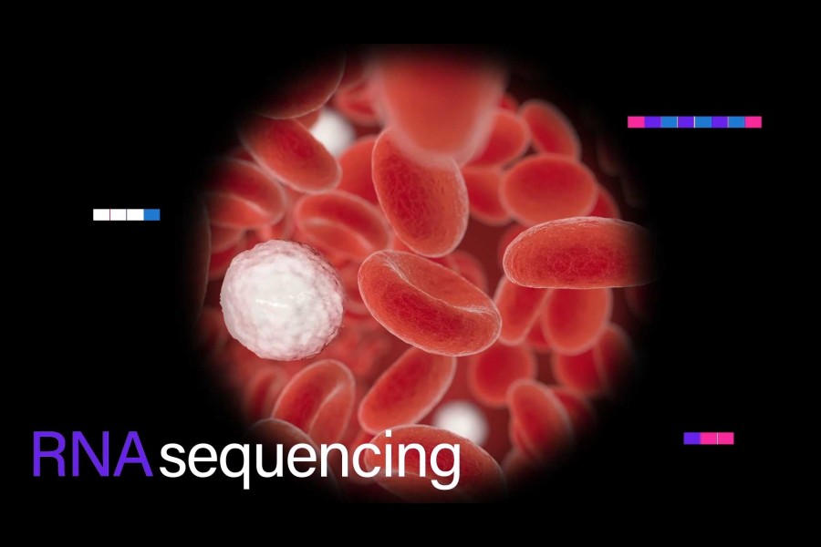Partnership to develop AI models for MS