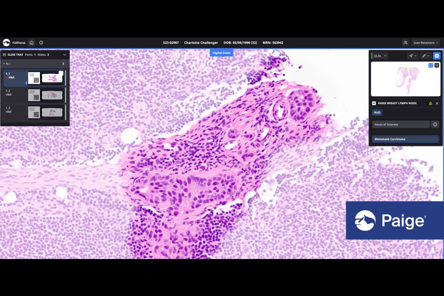 NHS Wales to trial AI-assisted pathology