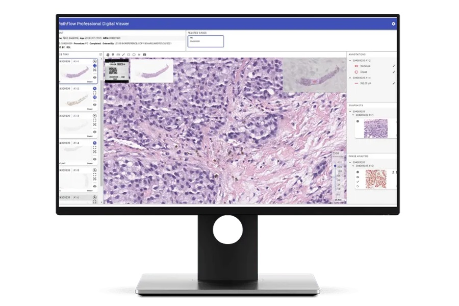 Gestalt Raises $7.5 million to develop AI pathology