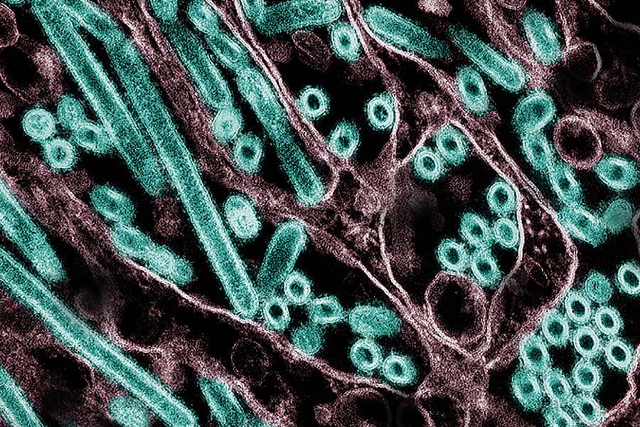 Avian influenza virus infection: a selection of research interest