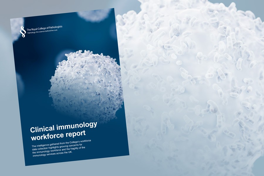 RCPath report highlights staff shortages in immunology services