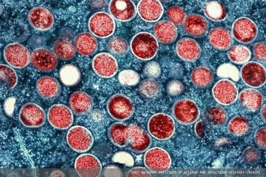 New mpox strain identified in England