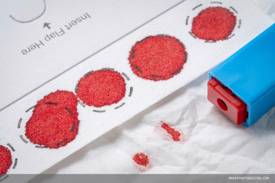 Dried blood spot samples can be used to detect Alzheimer's biomarkers