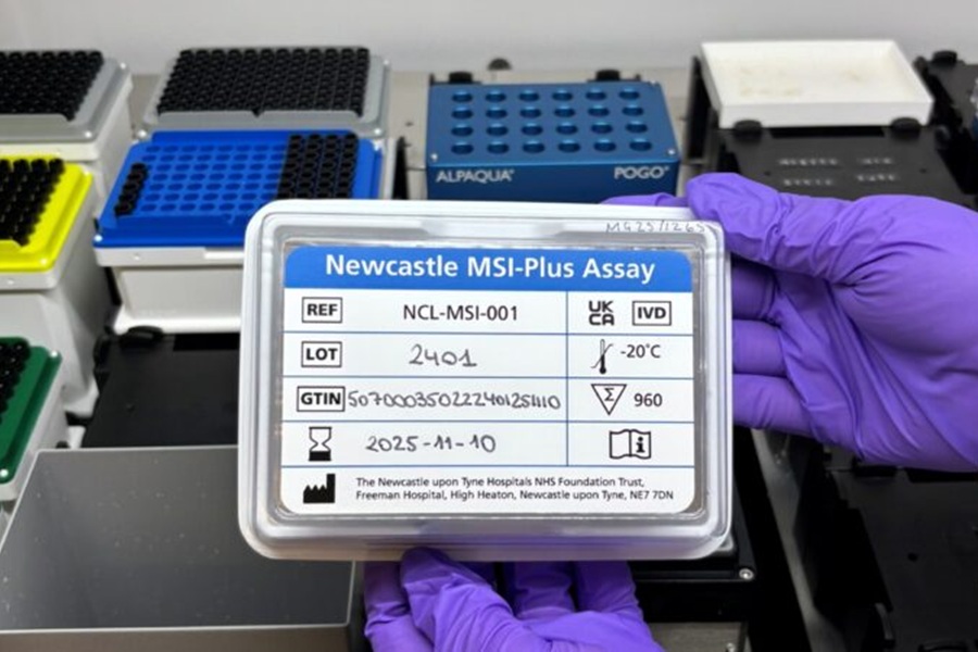 Newcastle Lynch syndrome test is rolled out across the UK for patients