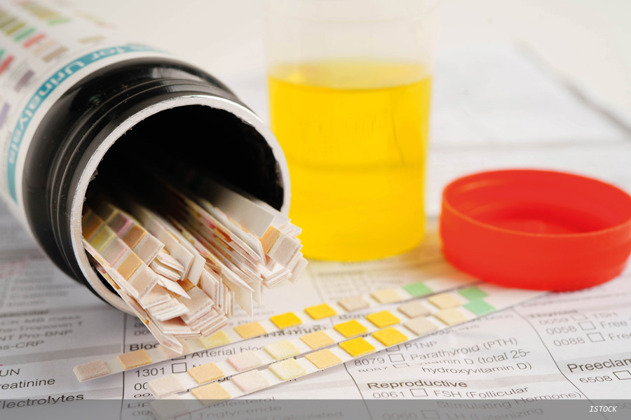 Evolution of urinalysis: the journey from dipstick to digital solution