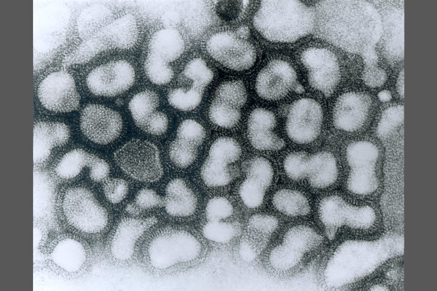 Influenza frequently missed in winter deaths, new study finds