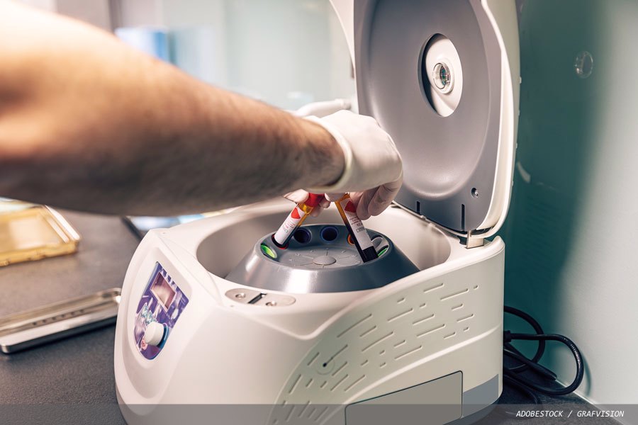 Plasma and serum viscosity ratio in diagnostic medicine