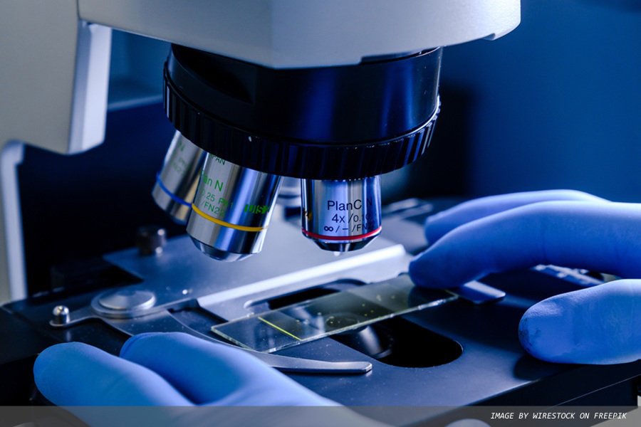 New AI tool to assist pathologists in complicated lung cancer analyses