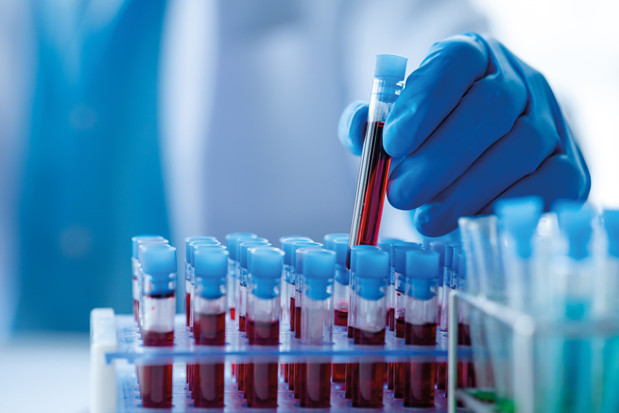 Breakthrough blood test could detect vascular disease earlier than ever
