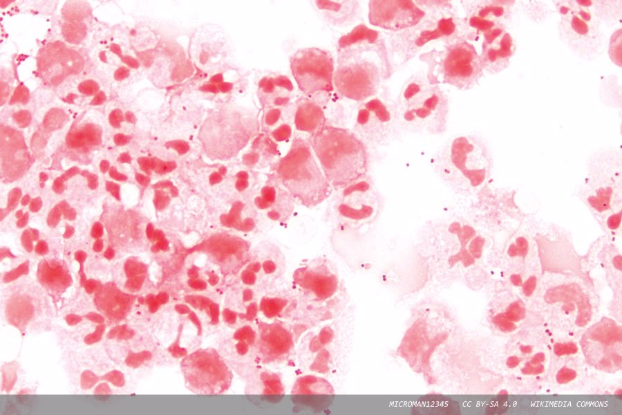 Changes in global disease patterns: the challenge for microbiologists