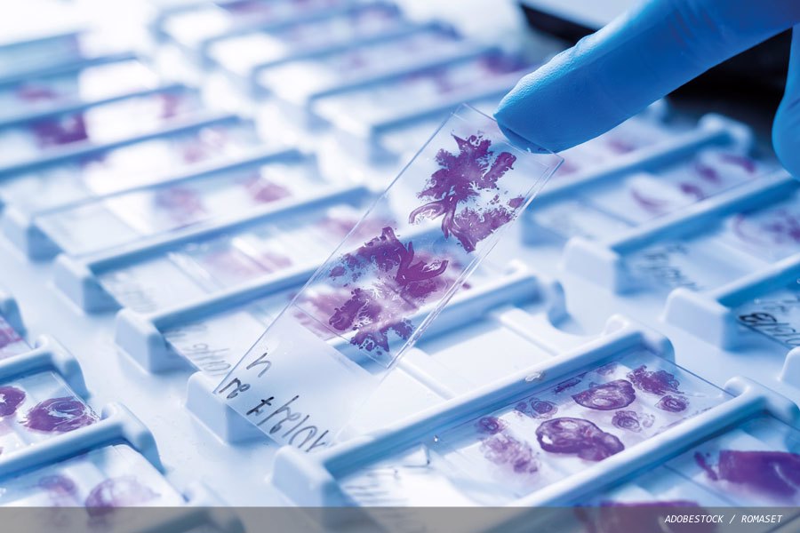 Cracks in the foundation:  glass slides and the future of digital pathology