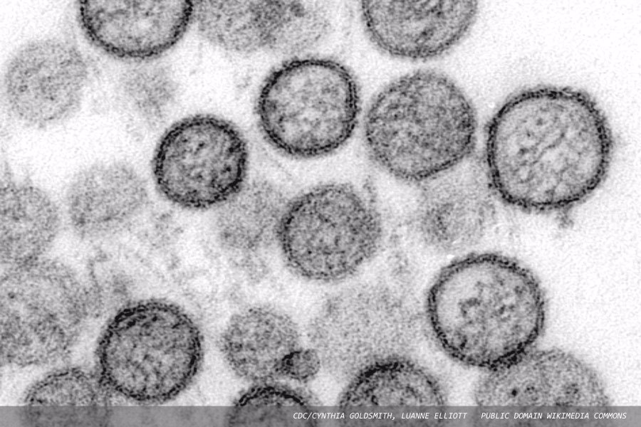 Hantavirus infection: a look beyond  that caused by the Andes strain