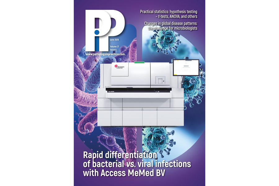 COVER STORY: Transforming infection diagnosis: 20-minute bacterial vs. viral test