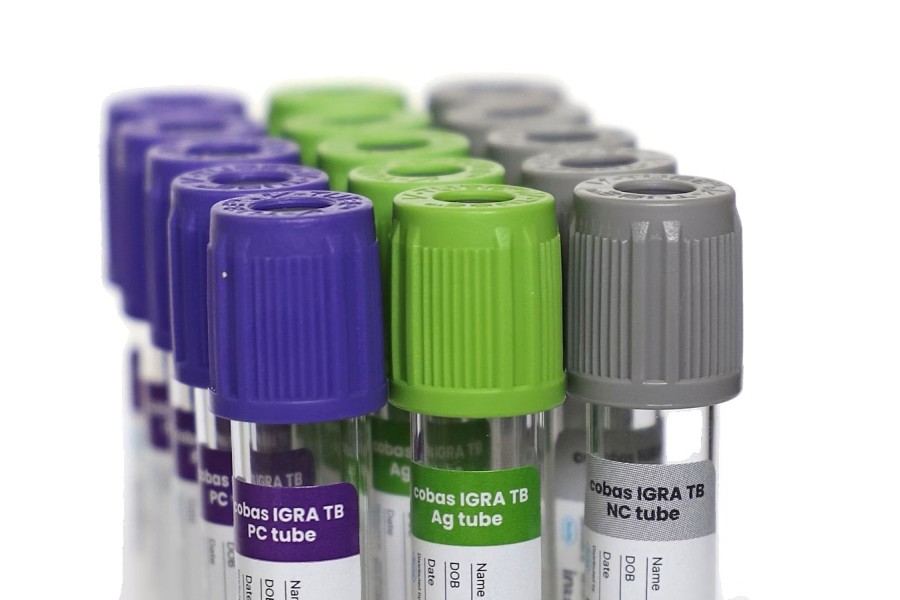 Roche’s tuberculosis blood test receives CE Mark
