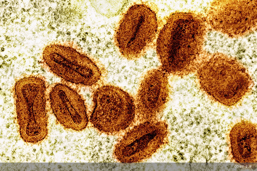 Additional resources now available for the fight against mpox