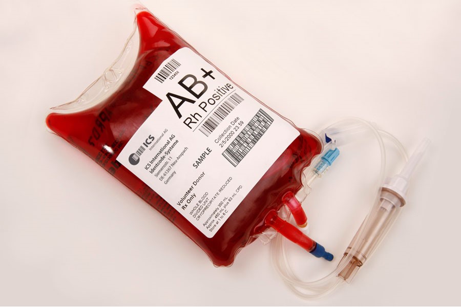 Stroke and Alzheimer’s tests could improve transfusion safety