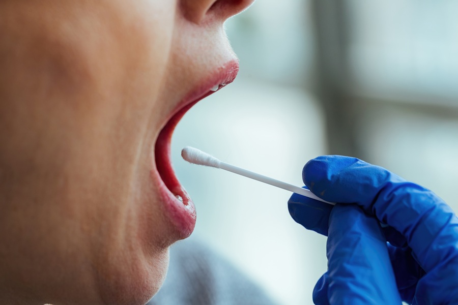 Oral microbiome could help detect gastrointestinal cancers