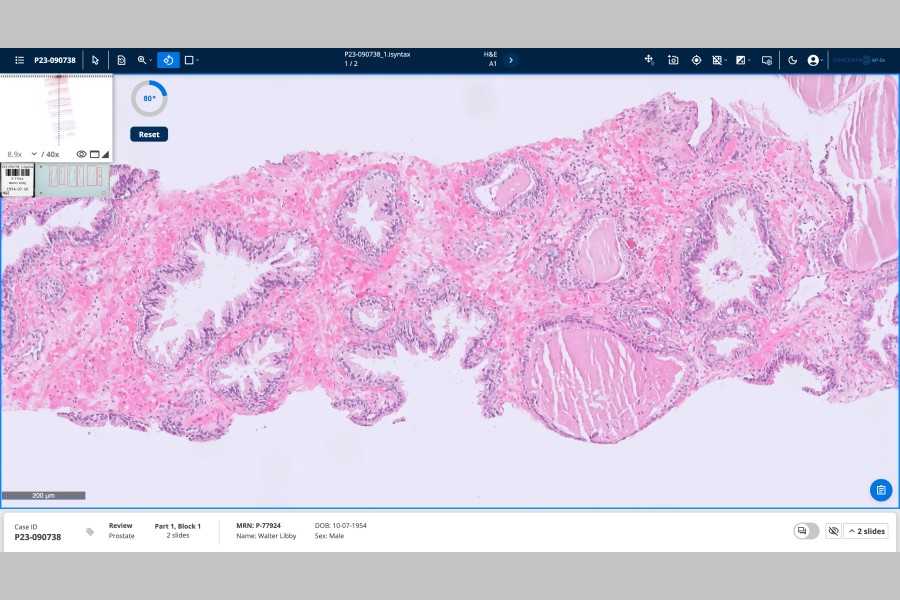 Unilabs advances digital pathology across Europe with Proscia