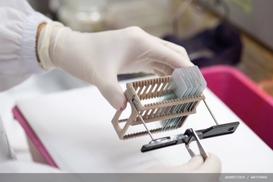 Improving laboratory efficiency: the hidden costs of manual slide handling
