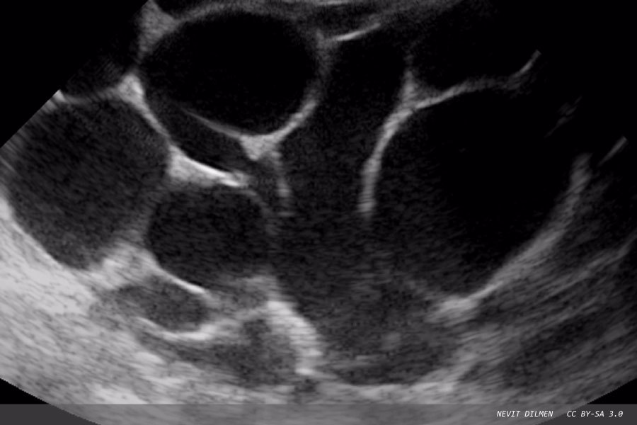 Closing the diagnostic gaps in women’s healthcare