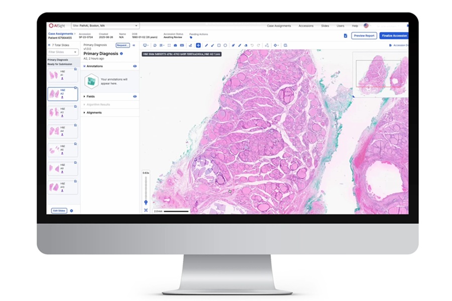 Broadening access to AI-driven diagnostics